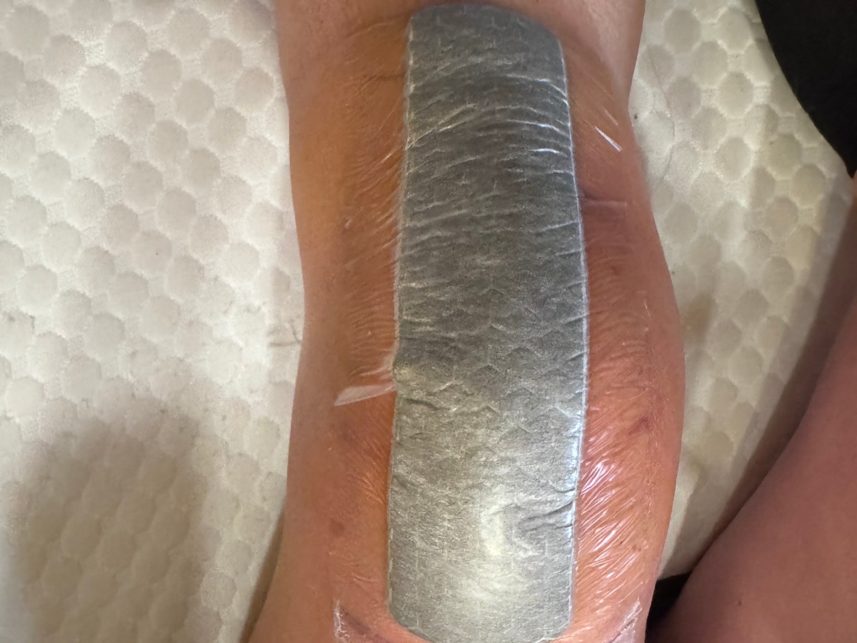 What I Wish I Knew Before Knee Replacement&nbsp;Surgery
